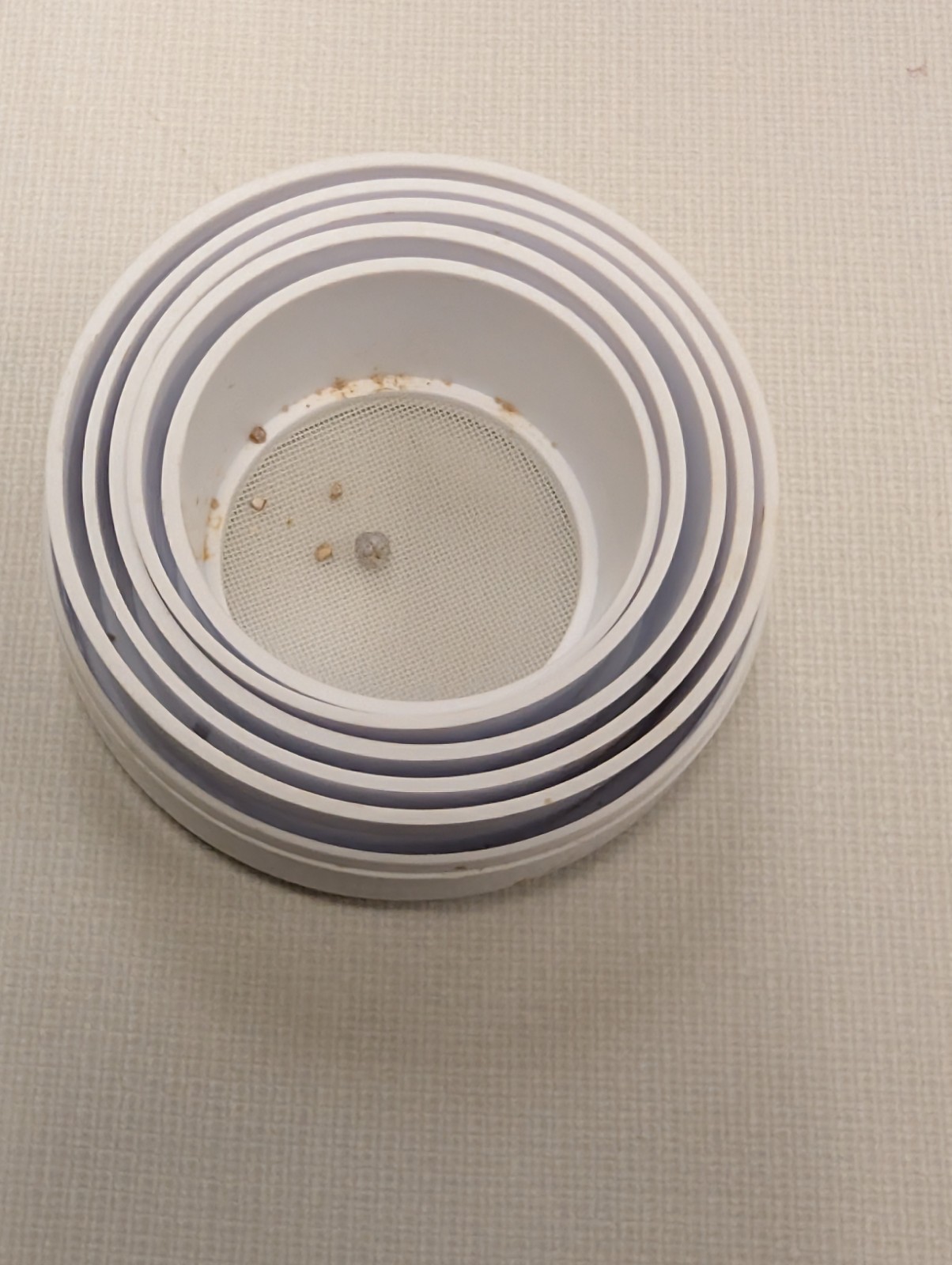 Real and Rare Kidney Stone